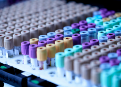 Бизнес идея: лаборатория по забору анализов - GrandActive